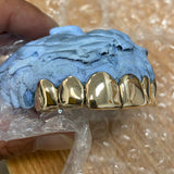 'Grillz'  14k Solid Gold Custom Fit