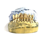 'Grillz'  14k Solid Gold Custom Fit